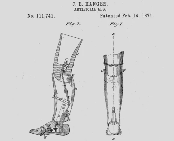 A drawing of Hanger's patent